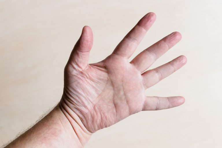 hand Rynkbehandling